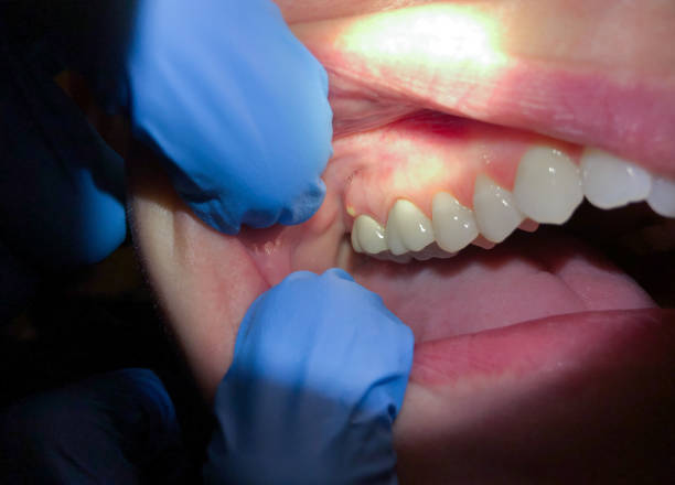 Best Emergency Treatment for Toothache in Garrettsville, OH