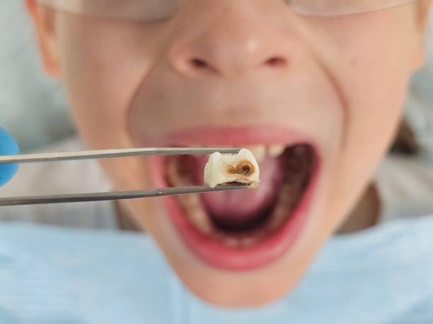 Best Emergency Dental Surgery in Garrettsville, OH